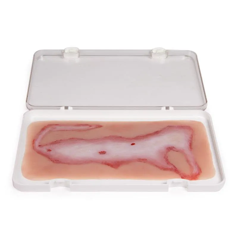 Wound Moulage Scalding Kit