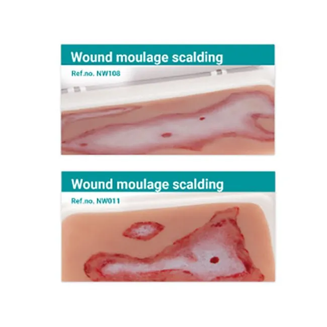 Wound Moulage Scalding Kit